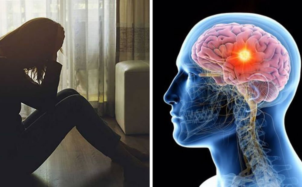 Lesiones cerebrales y PENSAMIENTOS