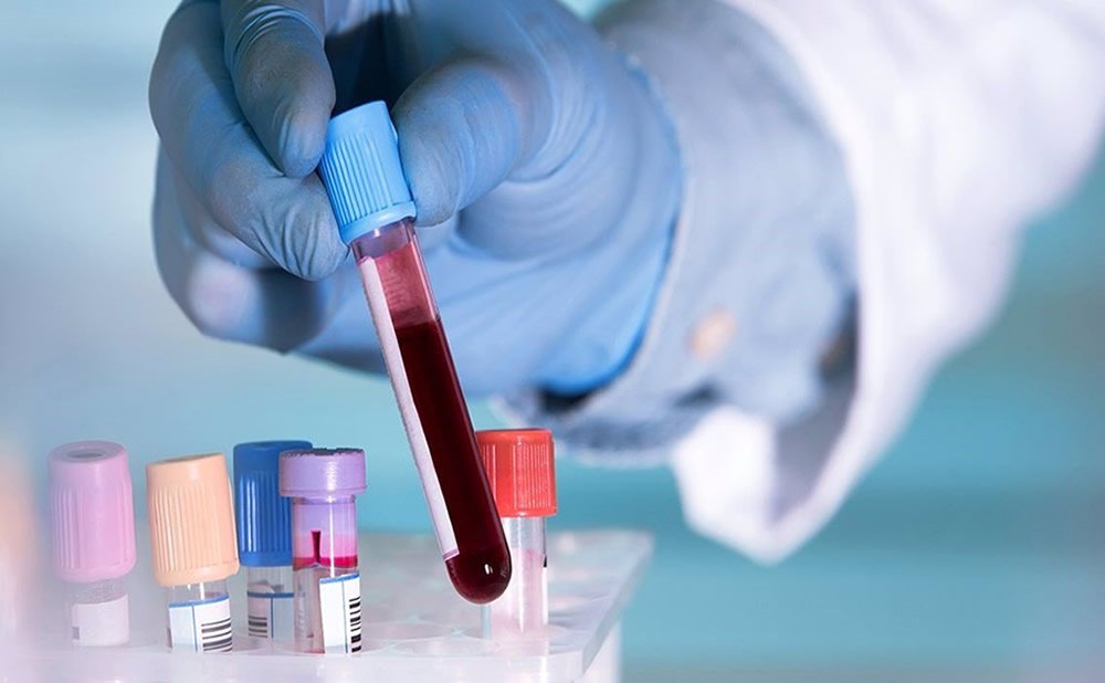 Glucosa en sangre pruebas depresion