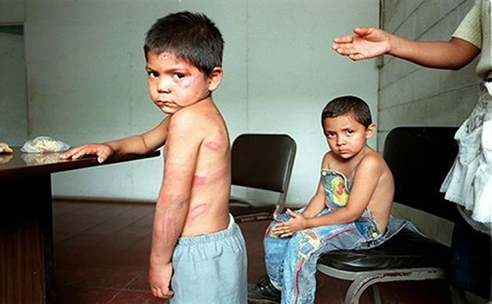 Niños en riesgo experiencias adversas en la infancia vinculadas al sistema de justicia